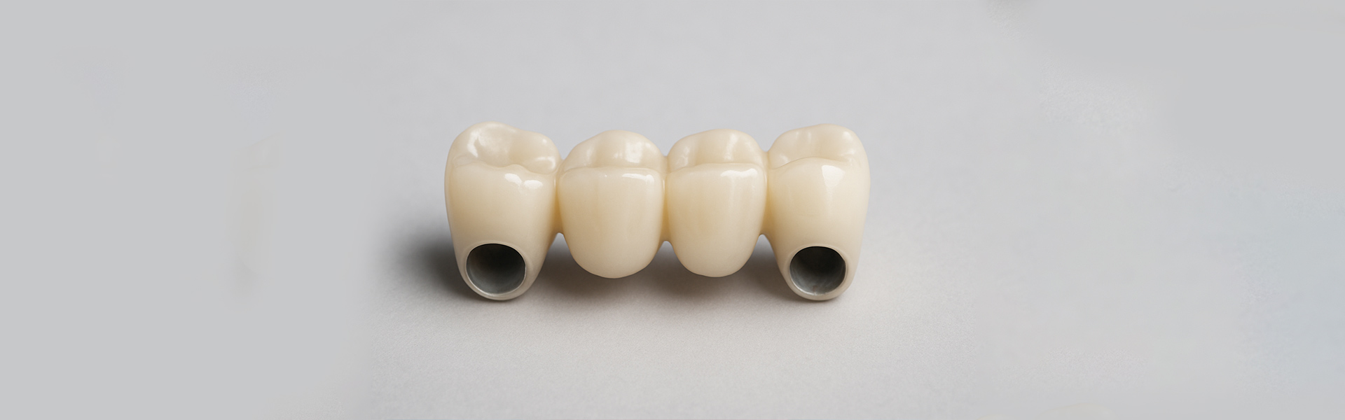 When is a Dental Bridge Necessary?