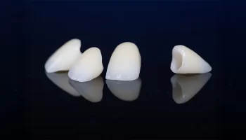 Are Dental Crowns Right for You? San Clemente’s Experts Explain