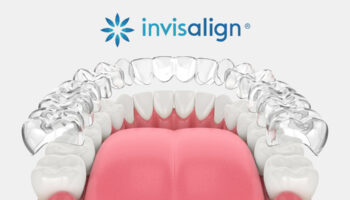Invisalign® in Huntington Beach: Why More Adults Are Choosing Clear Aligners in 2026