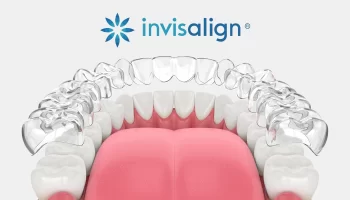 Invisalign® in Huntington Beach: Why More Adults Are Choosing Clear Aligners in 2026